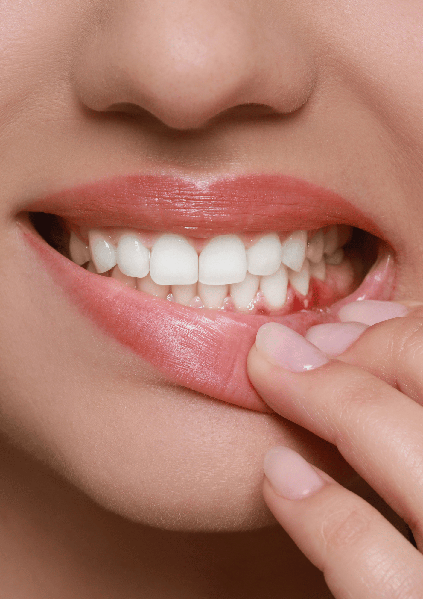 Bouche de femme ouverte montrnant ses dents et gencives